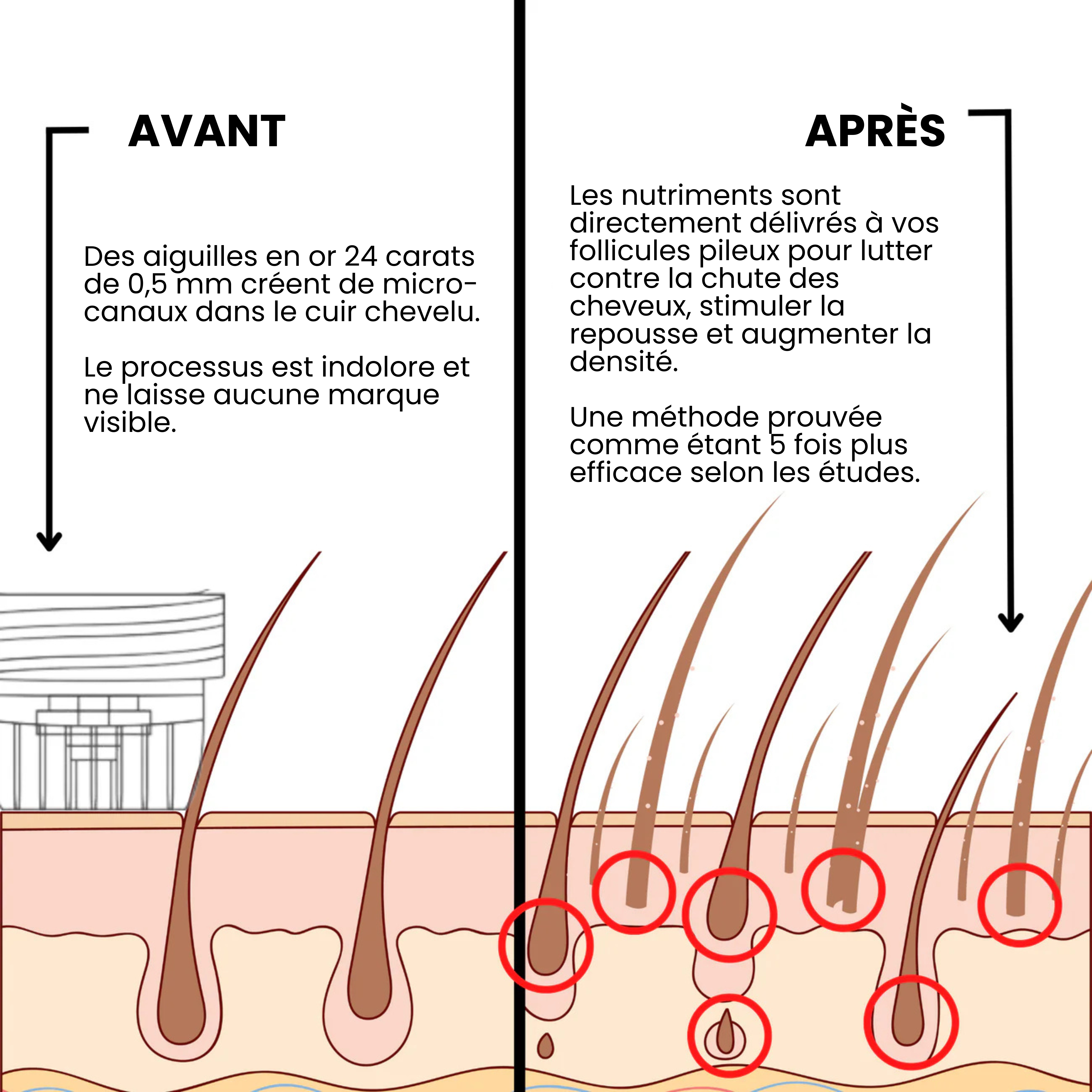 Renewal™ Repousse Des Cheveux